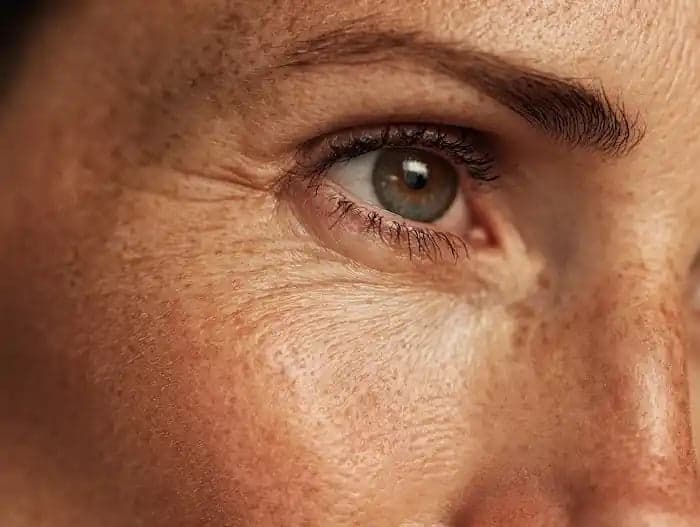 Best Anti Wrinkle Cream skin texture image for Prescription Skin