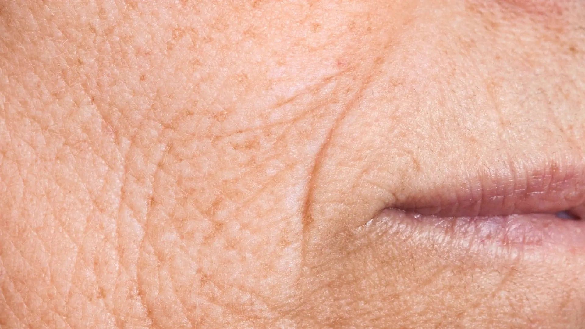 Menopause Skincare skin texture image for Prescription Skin