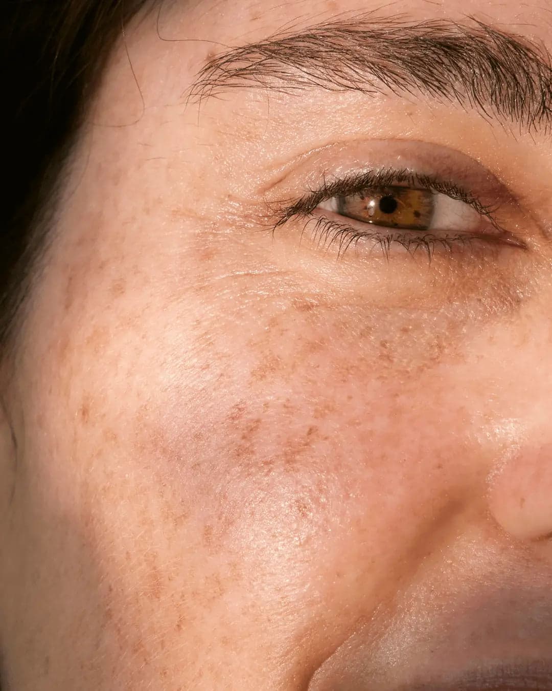Skin texture image for the Prescription Skin guide to your first 8 weeks on prescription skincare