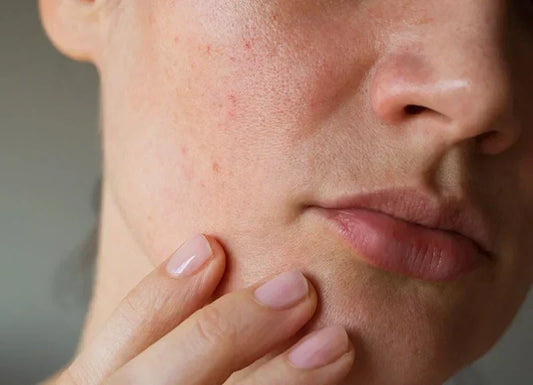 Custom skincare plans in Australia: how personalised routines work and when they are worth it