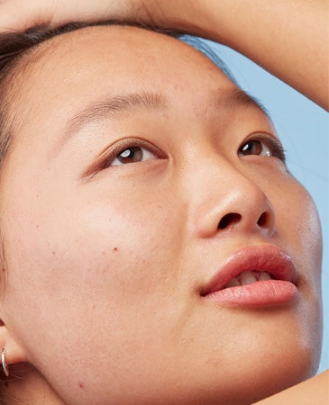 Retinol vs Tretinoin for Deep Wrinkles and Persistent Acne